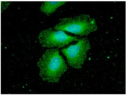 NM23-H2/NME2 Mouse anti-Human, Clone: 2000, Novus Biologicals 50 &mu;L | Buy Online | Novus Biologicals | Fisher Scientific